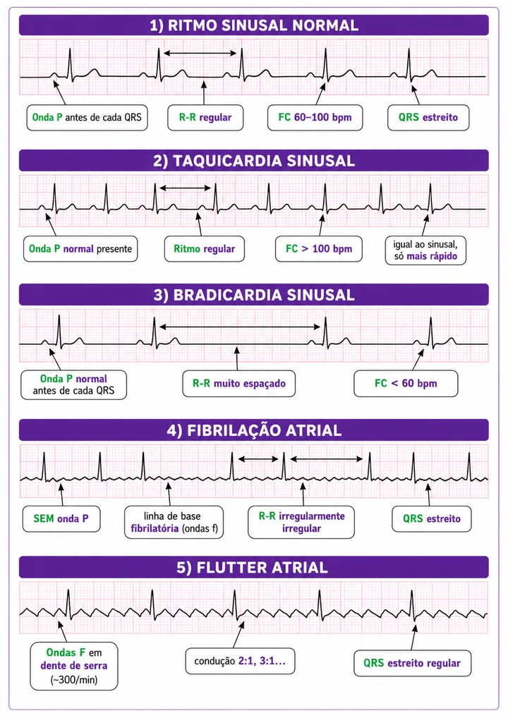 Página de traçados de ECG comentados